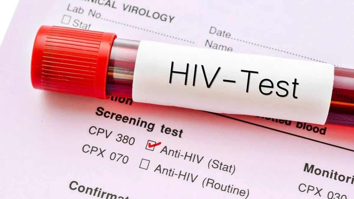 Kemenkes Buka Data, 3 Kelompok Ini Jadi Penyandang HIV Terbanyak