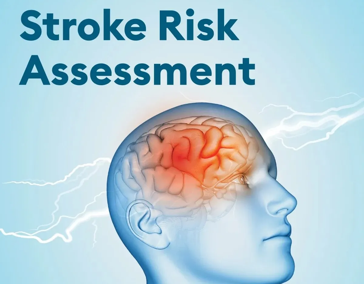 Setiap Menit Begitu Berharga: Stroke Jadi Penyebab Kematian Tertinggi di Indonesia