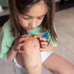 Dokter Ungkap Alasan Anak Dua Tahun Sering Terluka, Bukan “Terrible Two”