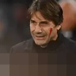 Antonio Conte Ungkap Tantangan Badai Cedera di Napoli, Soroti Kondisi Lukaku dan De Bruyne