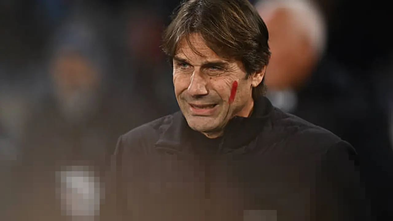 Antonio Conte Ungkap Tantangan Badai Cedera di Napoli, Soroti Kondisi Lukaku dan De Bruyne