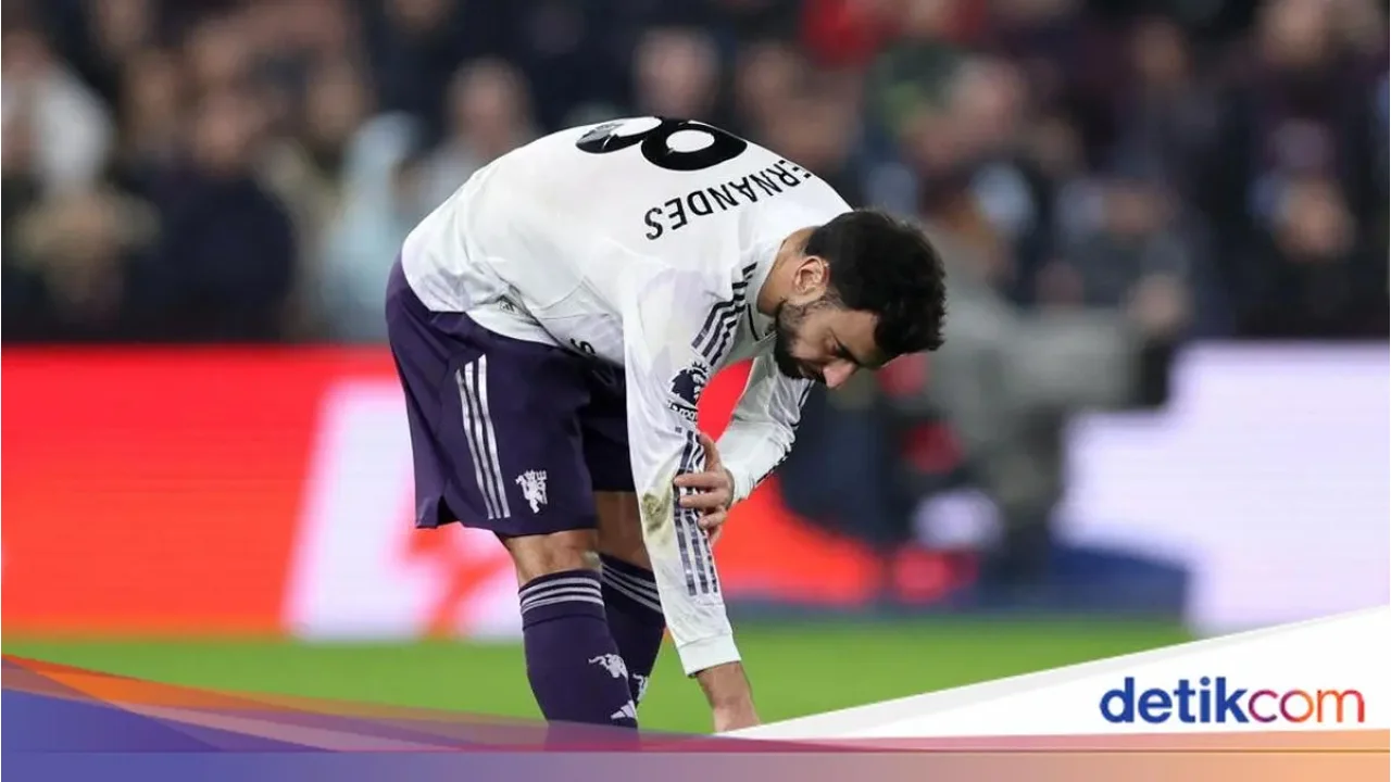 Cedera Lutut Paksa Bruno Fernandes Absen Lama, Bagaimana Nasib Manchester United?