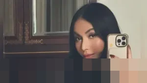 Denada hingga Asri Welas: Deretan Artis Indonesia yang Jalani Operasi Plastik Sepanjang 2025