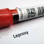 DPR Desak Kemenkes Perketat Tes Kesehatan PMI Usai Dua WNI Terjangkit Kusta di Rumania