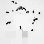 Jepang dan Lima Negara ASEAN Bersinergi dalam Studi Komprehensif Bakteri Resisten Obat