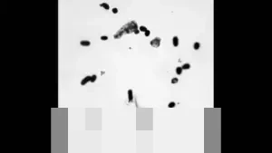 Jepang dan Lima Negara ASEAN Bersinergi dalam Studi Komprehensif Bakteri Resisten Obat