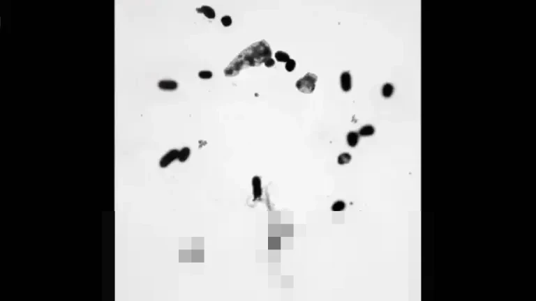 Jepang dan Lima Negara ASEAN Bersinergi dalam Studi Komprehensif Bakteri Resisten Obat Jepang dan Lima Negara ASEAN Bersinergi dalam Studi Komprehensif Bakteri Resisten Obat