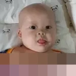 Perjuangan Tak Kenal Lelah Chiara, Bayi 8 Bulan dengan Teratoma Immature, Down Syndrome, dan Jantung Bocor