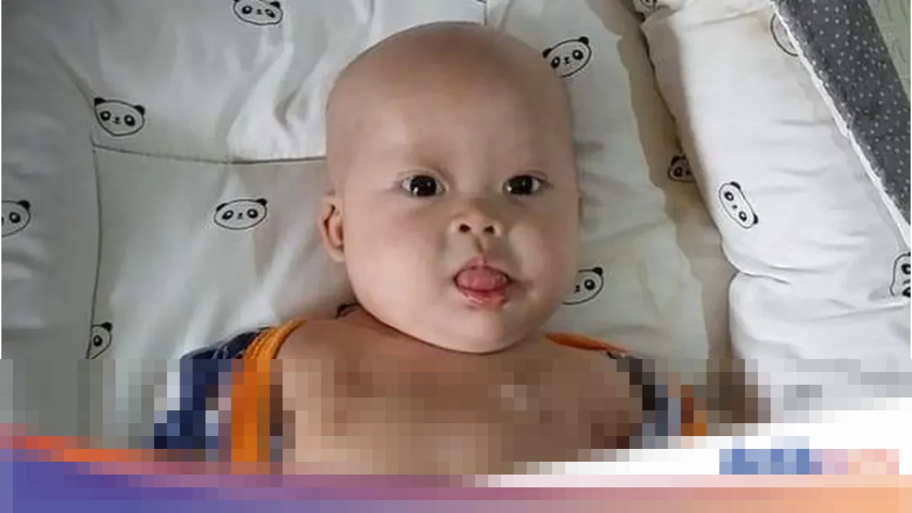 Perjuangan Tak Kenal Lelah Chiara, Bayi 8 Bulan dengan Teratoma Immature, Down Syndrome, dan Jantung Bocor