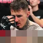 Tom Aspinall: “Kami Sedang Berusaha untuk Kembali” Setelah Operasi Mata Akibat Insiden UFC 321