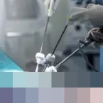 Bocah 4 Tahun Korban Peluru Nyasar Tawuran di Medan Akan Jalani Operasi Mata, Biaya Ditanggung Wali Kota