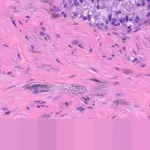 Indonesia, Turki, dan 20 Negara Muslim Lainnya Kecam Kunjungan Menlu Israel ke Somaliland: Langgar Kedaulatan Somalia