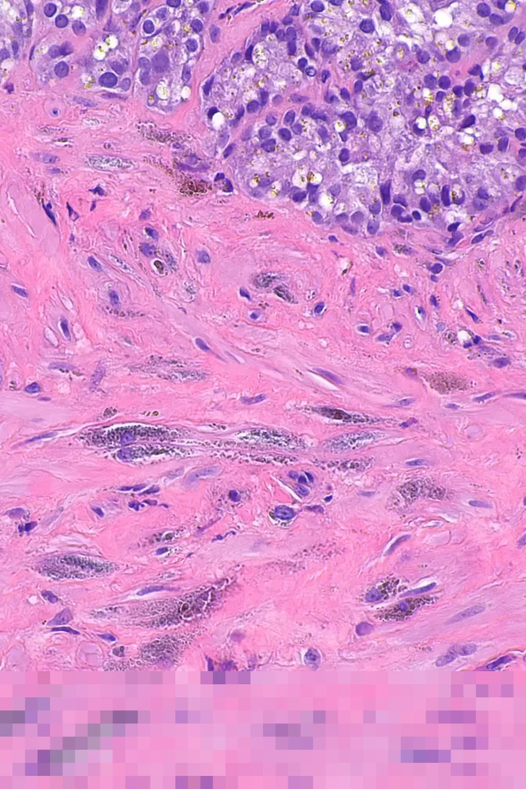 Indonesia, Turki, dan 20 Negara Muslim Lainnya Kecam Kunjungan Menlu Israel ke Somaliland: Langgar Kedaulatan Somalia