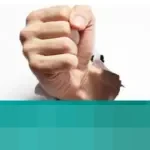 Korban Penganiayaan Tukang Parkir di Sleman Pilih Tak Lapor Polisi, Pertimbangkan Faktor Kemanusiaan