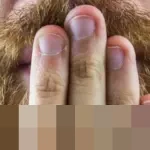 Mengatasi Penyusutan Organ Intim Pria: Panduan Lengkap dari Ahli Kesehatan dan Gaya Hidup