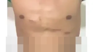 Pelatih Perseta 1970: “Alhamdulillah Aman, Firman Nugraha Sudah Sehat Kembali”