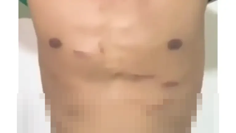 Pelatih Perseta 1970: “Alhamdulillah Aman, Firman Nugraha Sudah Sehat Kembali”