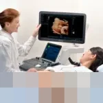 POGI Gaungkan Gerakan SPRIN: Deteksi Dini Kehamilan Kunci Selamatkan Ibu dan Bayi dengan Teknologi Mindray