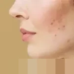 Waspada! 15 Pemicu Breakout Kulit yang Sering Terabaikan, dari Produk hingga Stres