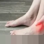 Waspada! Asam Urat Bukan Sekadar Nyeri Sendi, Berpotensi Picu Penyakit Jantung dan Stroke