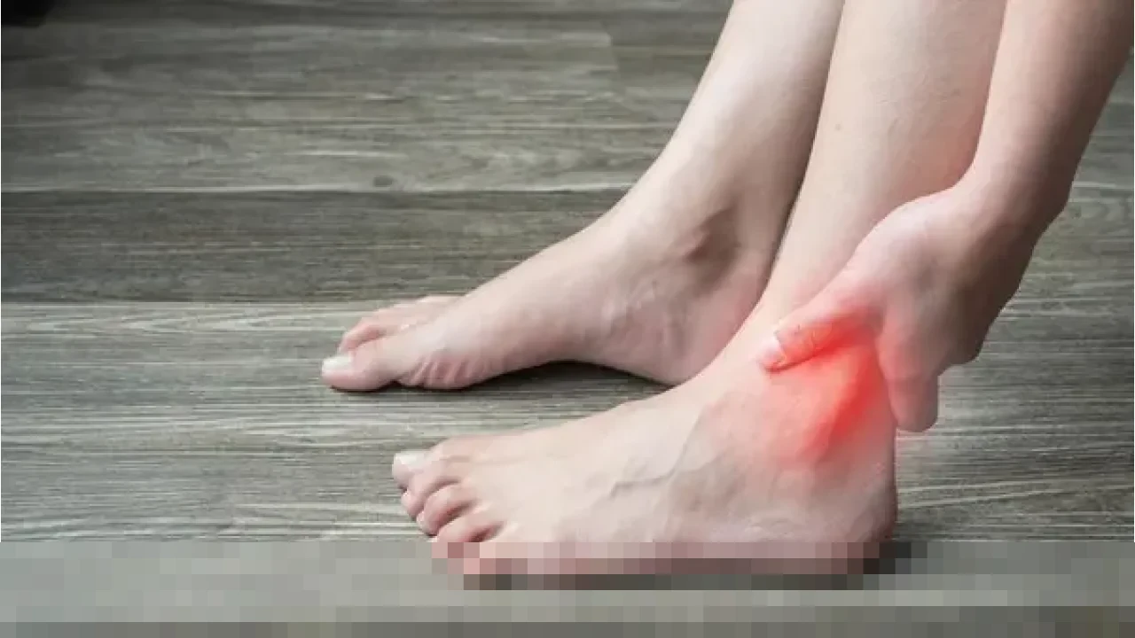 Waspada! Asam Urat Bukan Sekadar Nyeri Sendi, Berpotensi Picu Penyakit Jantung dan Stroke